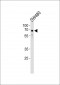 TRIM29 Antibody (Center)